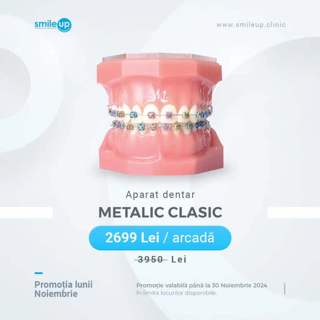 Aparat dentar metalic clasic