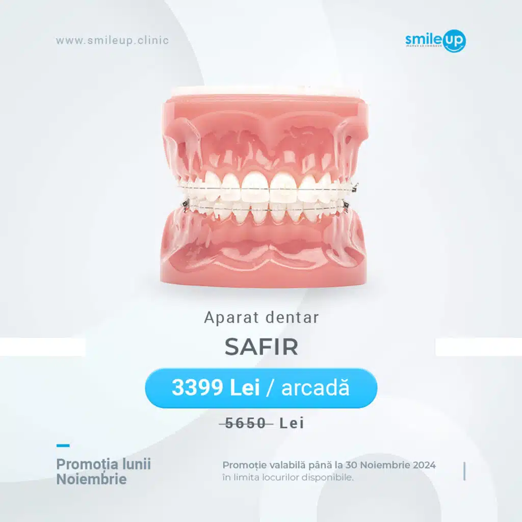 Aparat dentar Safir