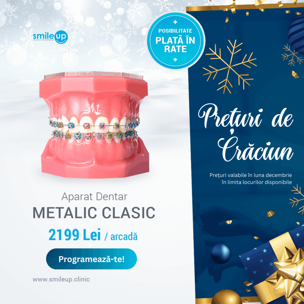 Aparat dentar Metalic Clasic