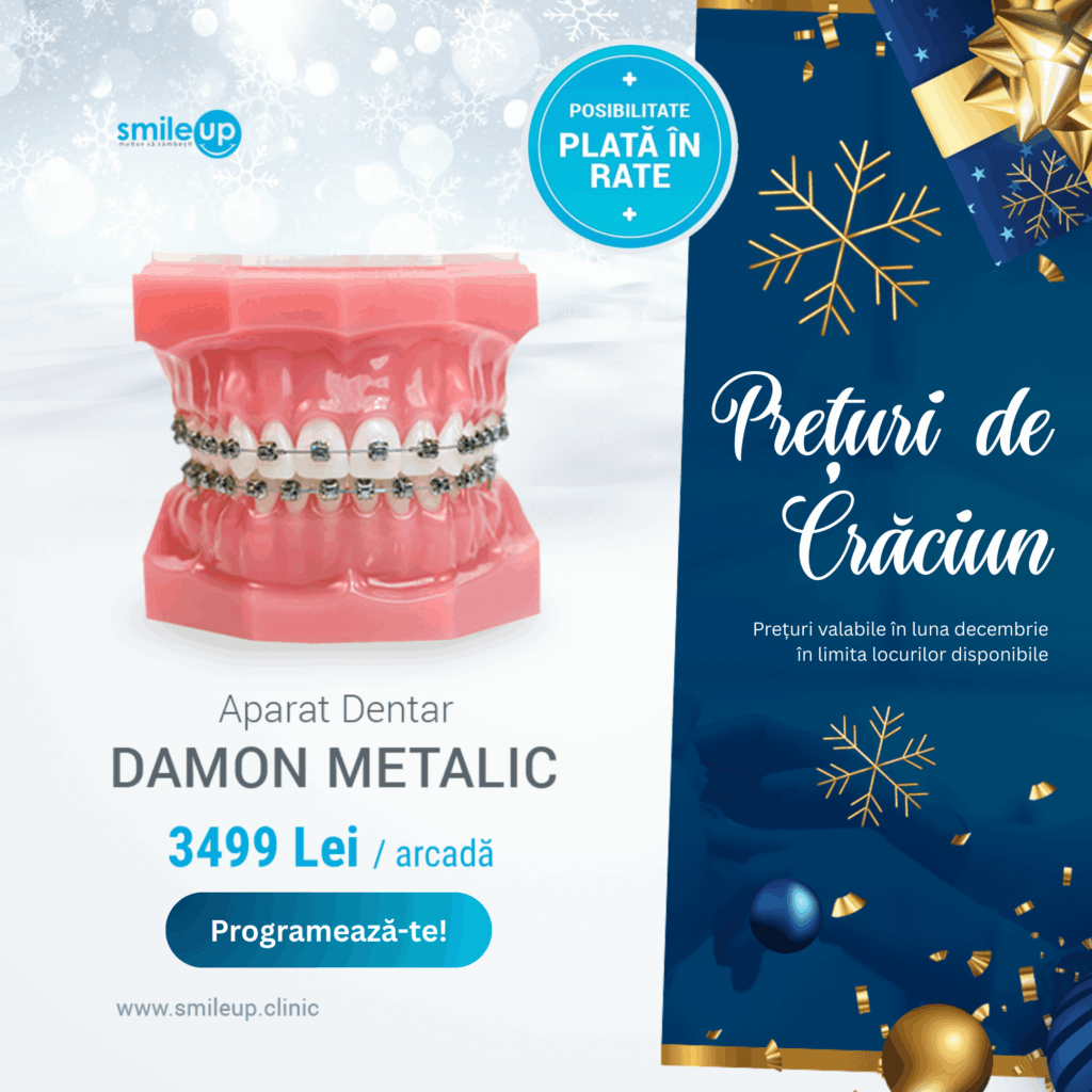 Aparat dentar Damon Metalic