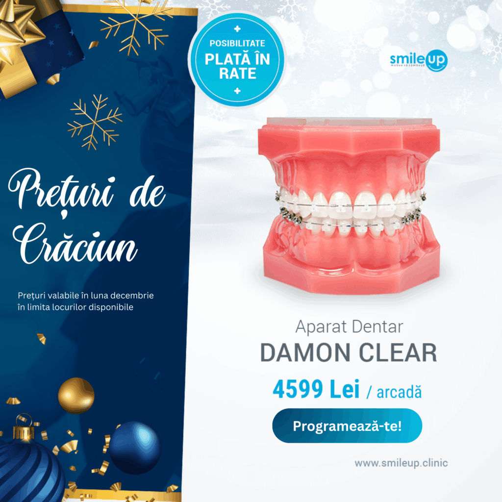 Aparat dentar Damon Clear