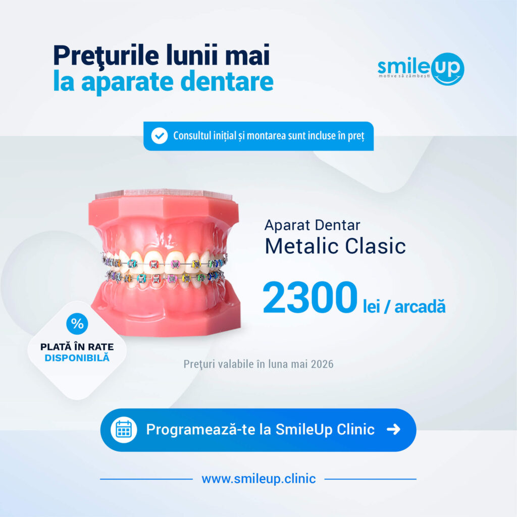 Advertisement banner: May prices for dental appliances with SmileUp logo and a blue promo bar reading 'Consultul inițial și montarea...'