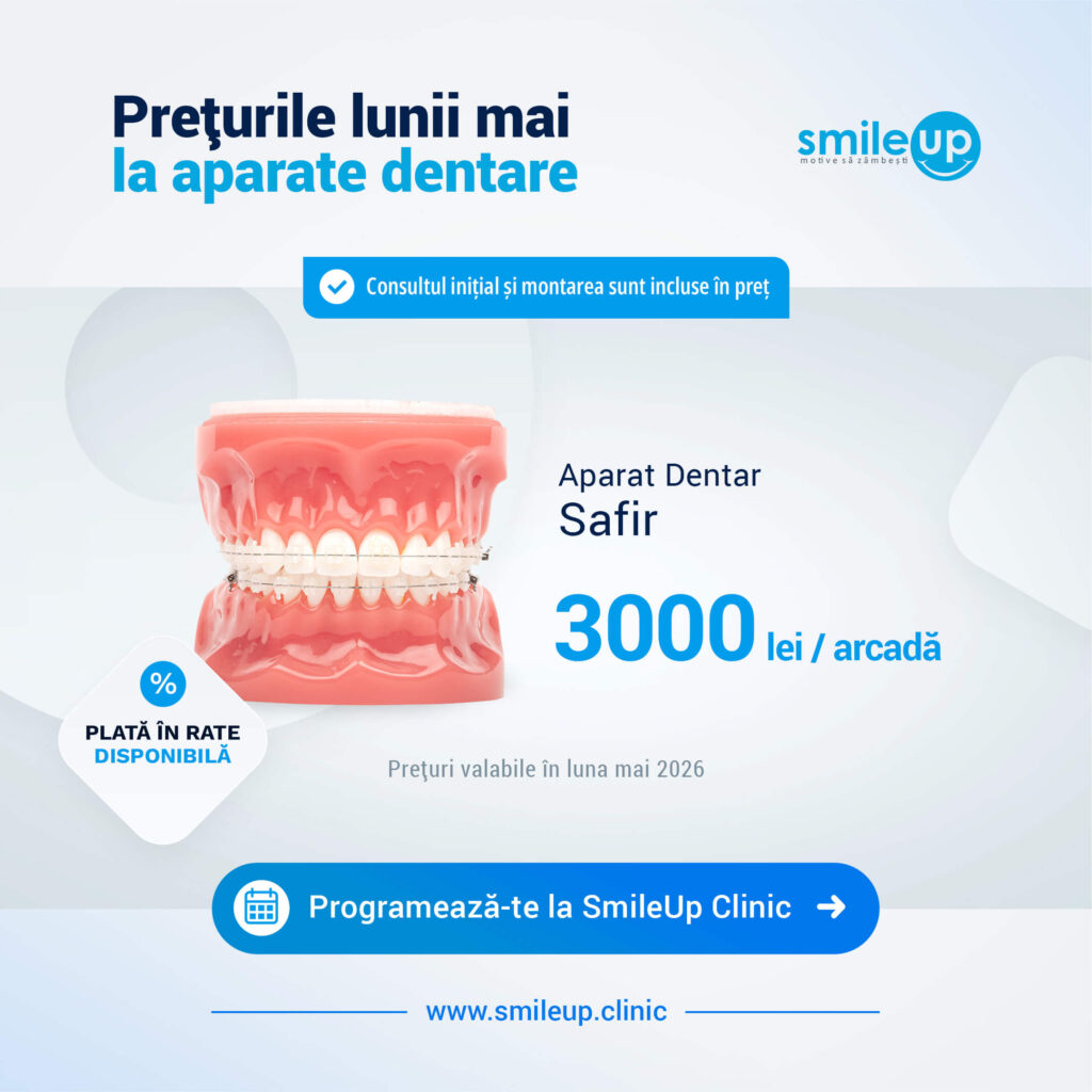 Banner announcing May prices for dental devices, with SmileUp logo and a 3D dental model.