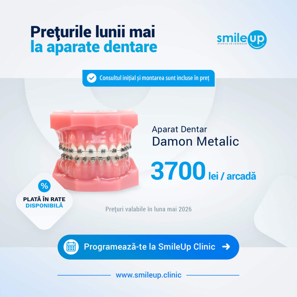 Promotional banner showing a pink dental model with braces and Romanian text about dental prices and SmileUp Clinic branding