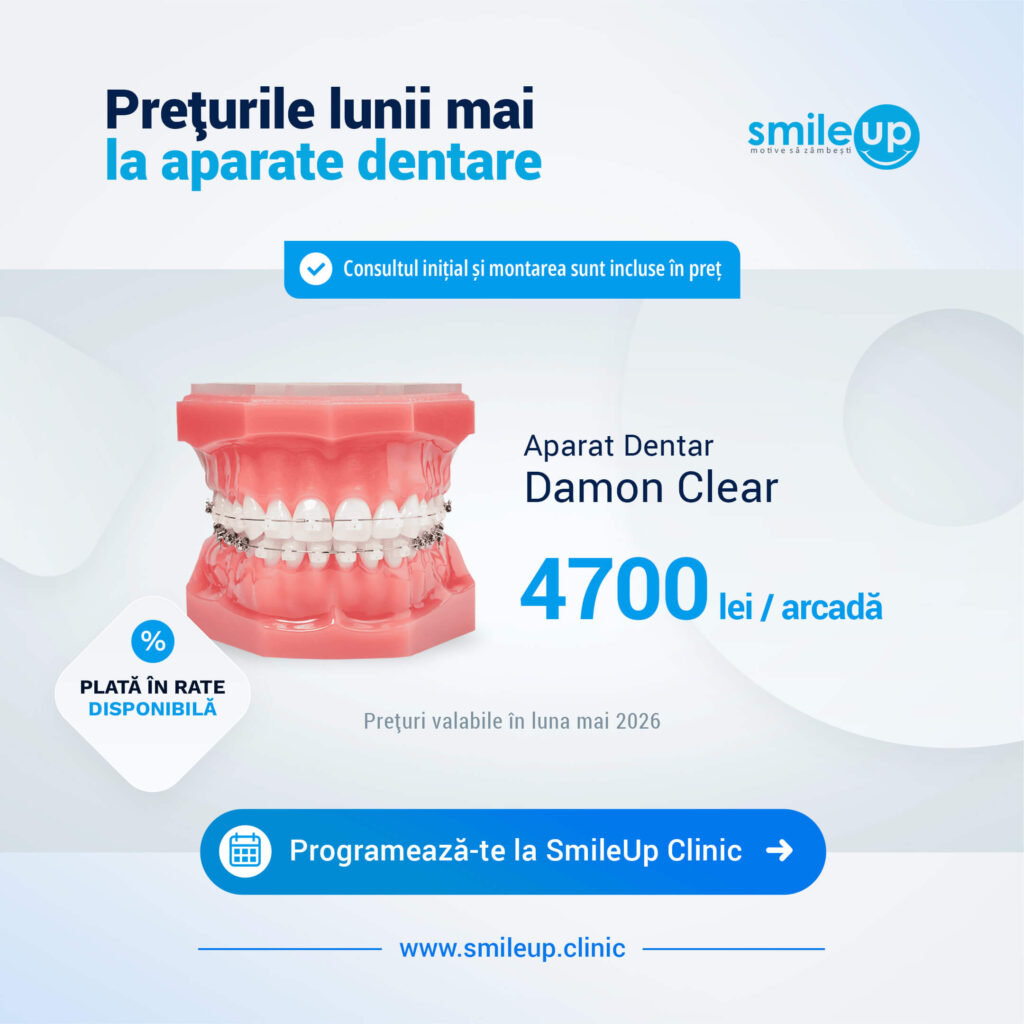 Banner publicitar SmileUp: prețuri ale aparatelor dentare în luna mai, cu logo-ul SmileUp în dreapta.