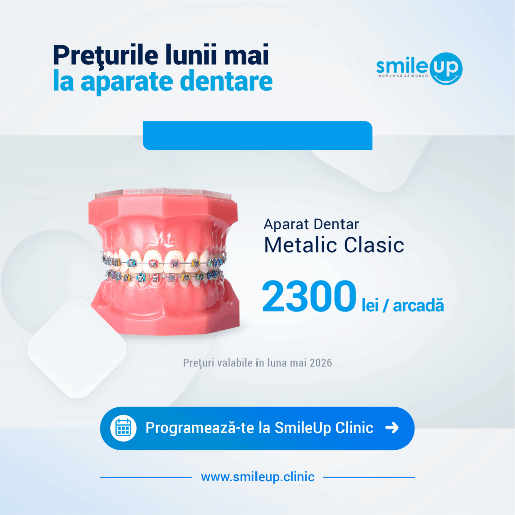 Banner announcing May prices for dental appliances with a braces model and SmileUp logo at right.