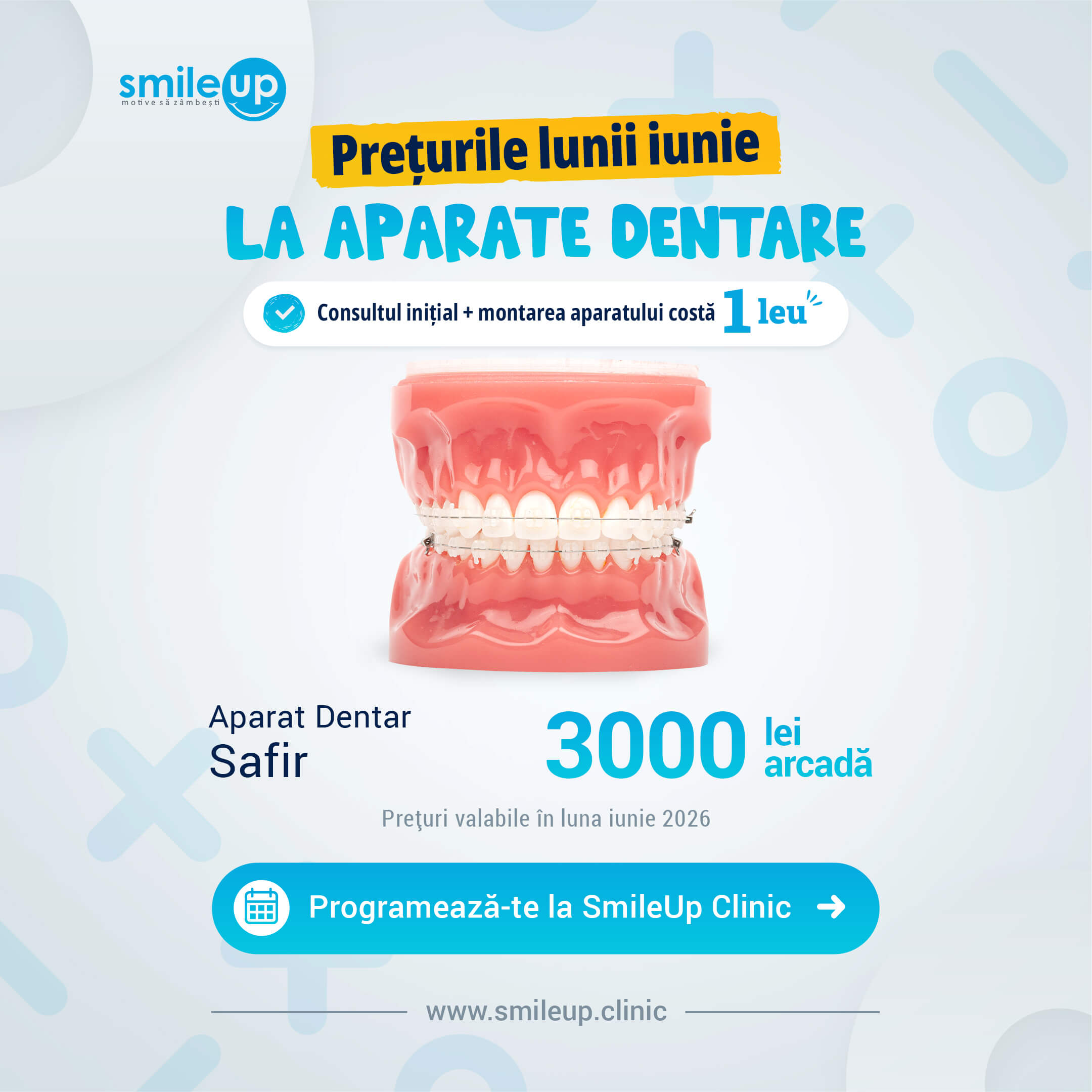 Banner promoțional SmileUp despre aparate dentare – prețuri lunii iunie, cu text explicativ în română: 1 leu pentru consult + montare și informații despre aparate dentare