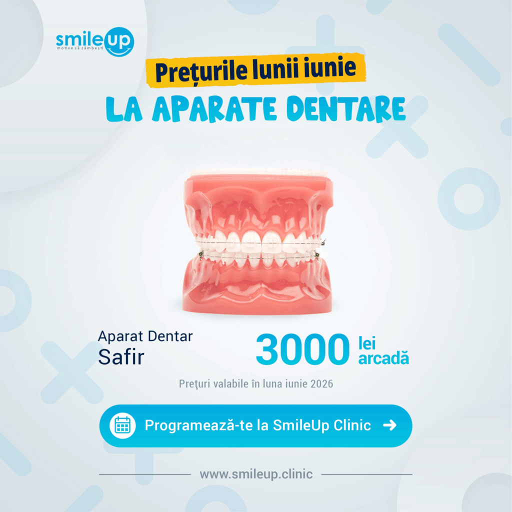 Banner advertising June prices for dental appliances with a stacked dental model and SmileUp logo in Romanian text: Preturile lunii iunie la aparate dentare.