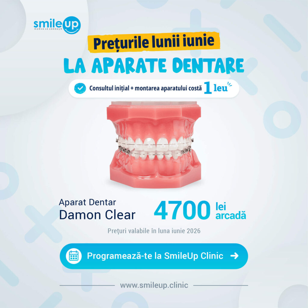 Promotional banner for SmileUp Clinic announcing June prices for dental braces, showing a braces model and starting price 4700 lei arcadă (monthly special)