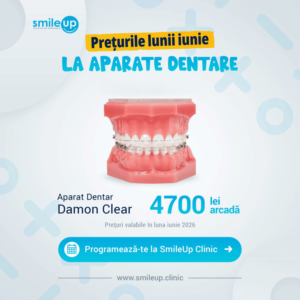 Poster promoting June prices for dental braces at SmileUp Clinic, featuring a dental arch model and Romanian pricing text.