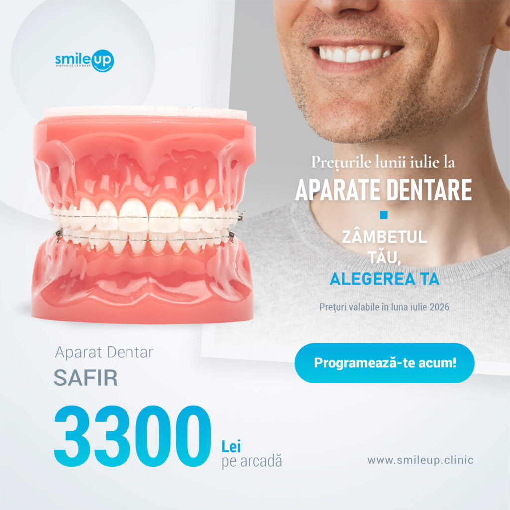 Promotional dental banner showing a teeth model with braces beside a smiling man and Romanian text about dental appliances (SmileUp).