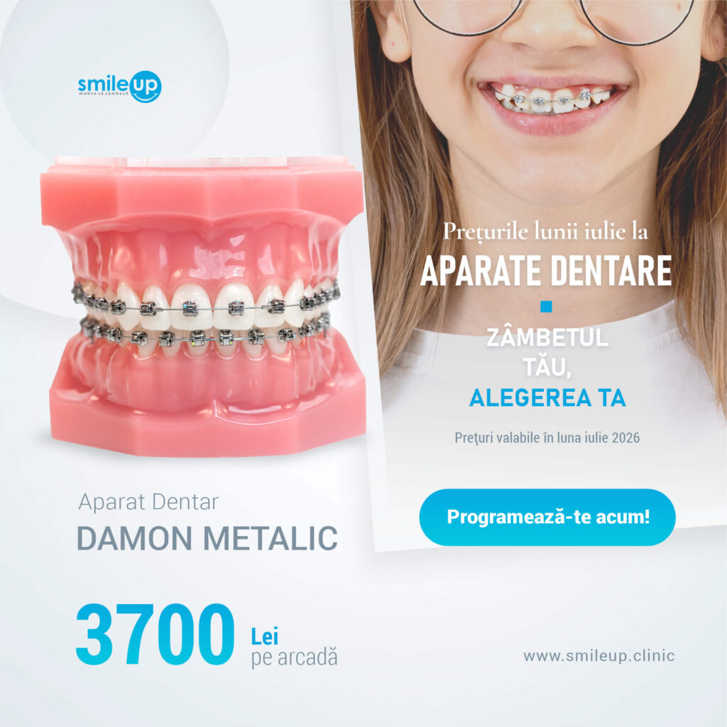Two-panel banner: left shows a pink dental model with braces, right shows a smiling person with braces and glasses; includes Smile Up branding.