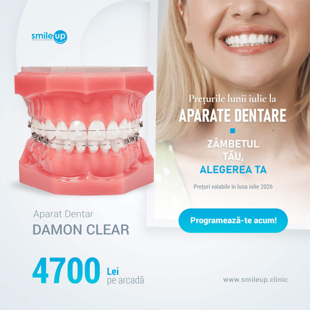 Split-screen dental ad: pink dental model on the left and a smiling woman's mouth on the right with Smile Up logo and Romanian pricing text.