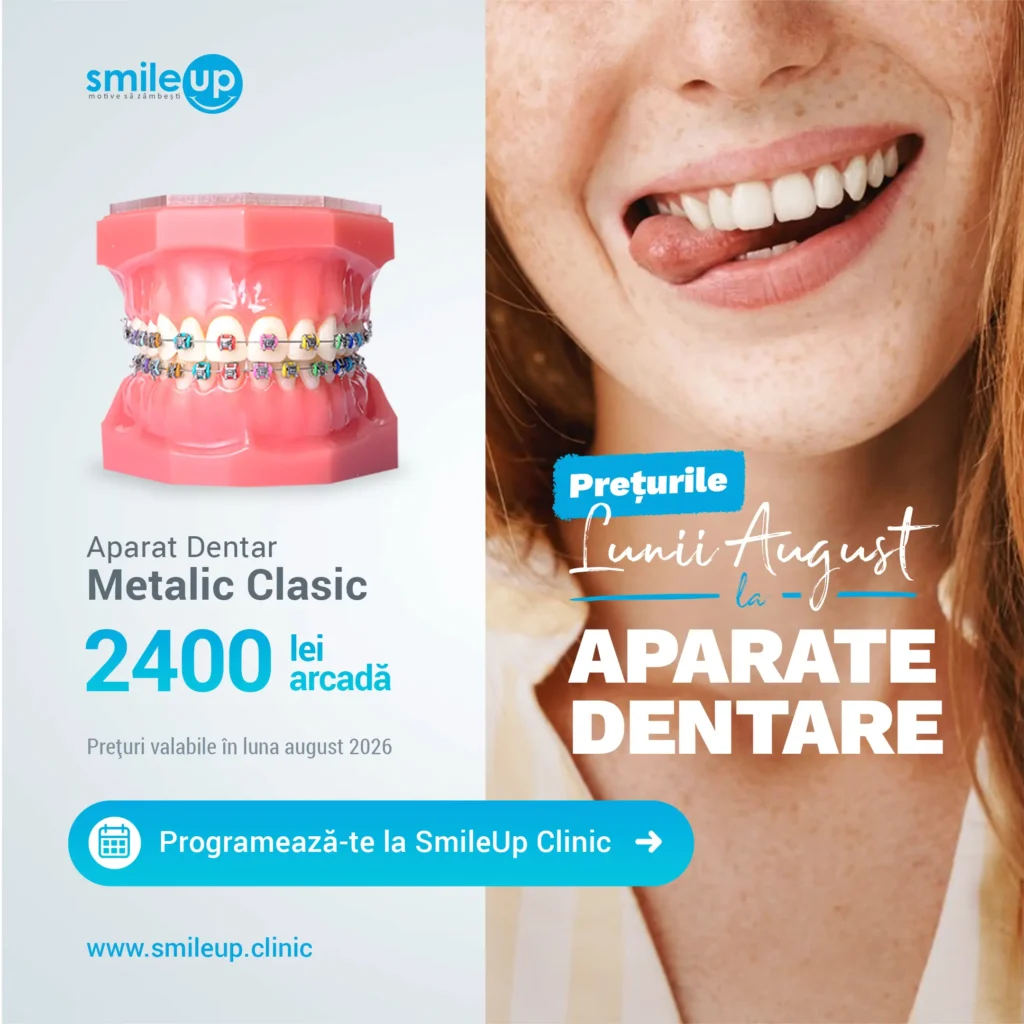 Split-screen ad: left shows a pink dental model with colorful braces and the SmileUp logo; right shows a smiling freckled woman with braces.
