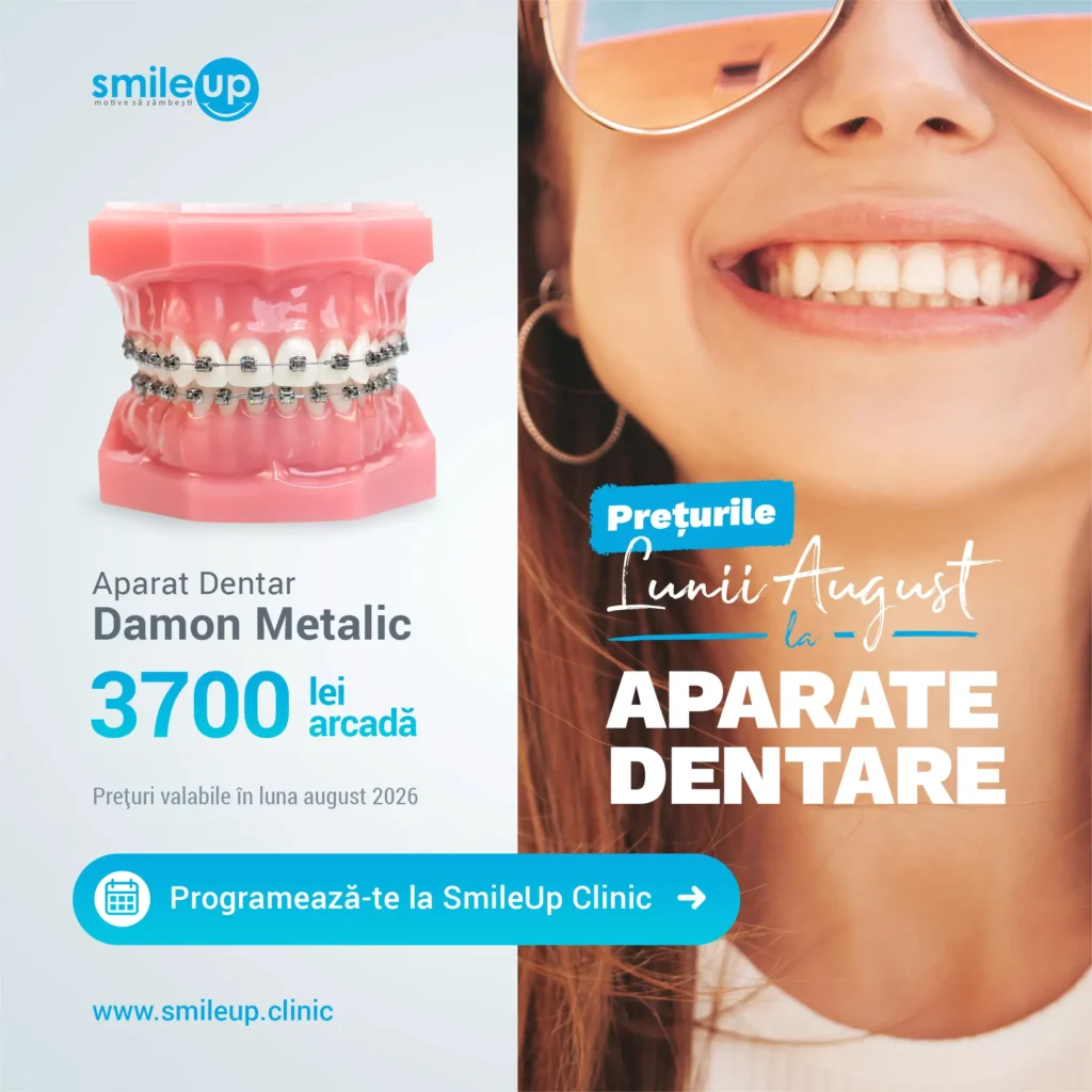 Split-screen ad: left shows a pink dental model with braces; right shows a smiling woman with sunglasses and the SmileUp Clinic logo,”