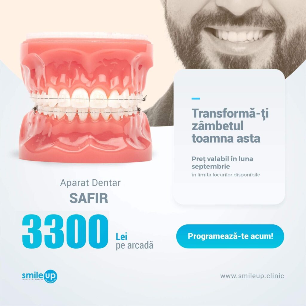 Dental model with braces beside a smiling man, advertising dental transformation in Romanian (Programează-te acum).